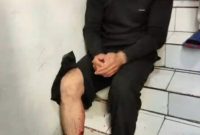 قاتل وحشی، زمین گیر شد